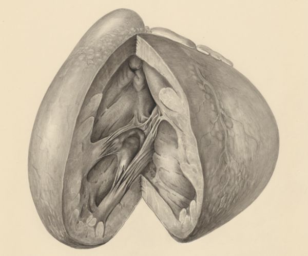 H.G Wetselaar, Heart