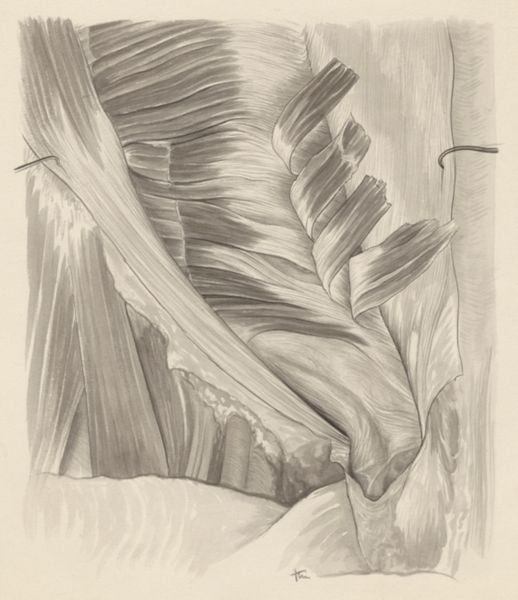 J Tinkelenberg, Tissue of the inguinal