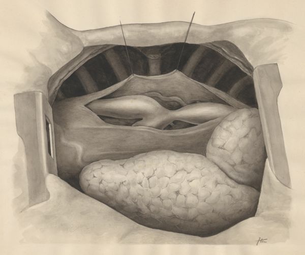 J Tinkelenberg, Part of the heart and circulatory system