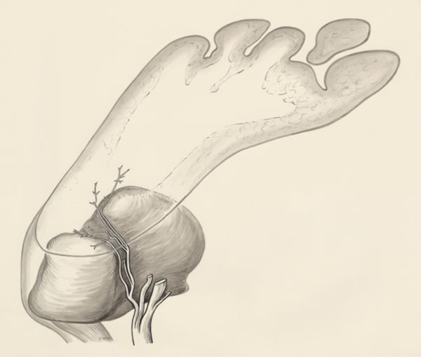 J Wetselaar-Whittaker, Heel, seen from below