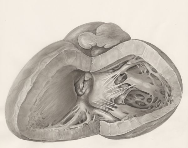 H.G Wetselaar, Heart