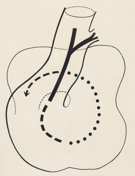 J Tinkelenberg, Schematic representation of a part of the heart