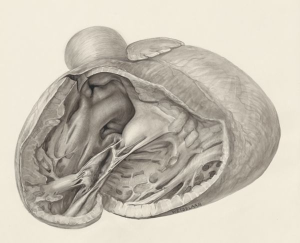 H.G Wetselaar, Heart