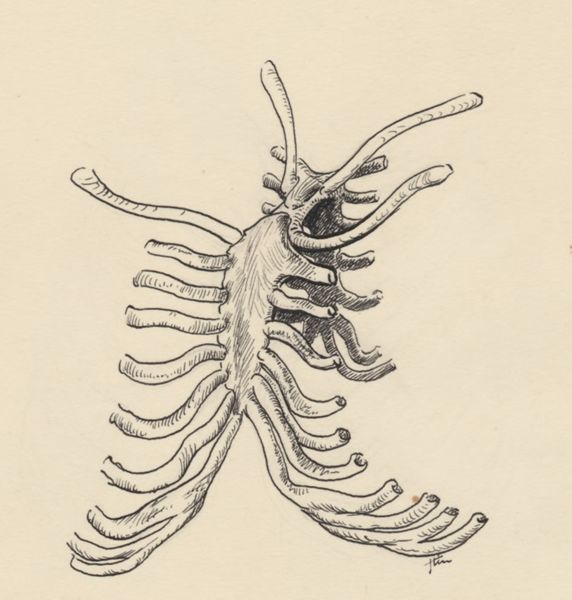 J Tinkelenberg, Deformed ribcage