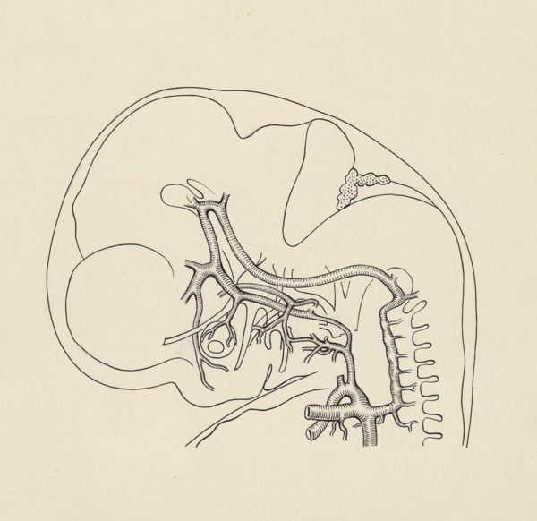 J Tinkelenberg, Cardiovascular system of an embryo