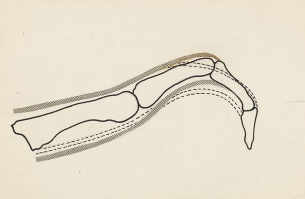 Harry de Bles, Schematic representation of the finger