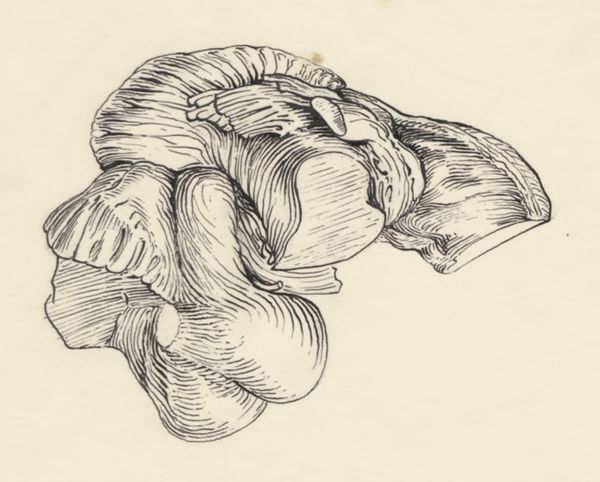 J Tinkelenberg, Neuroanatomy, possibly of a whale