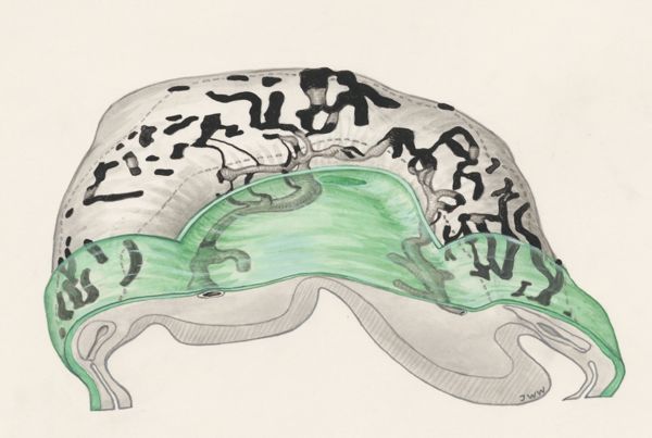 J Wetselaar-Whittaker, Two somites of a mouse