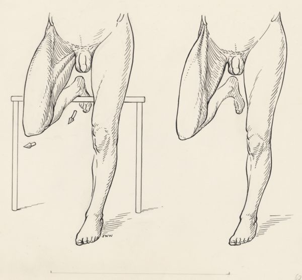 J Wetselaar-Whittaker, Movement of the male upper leg