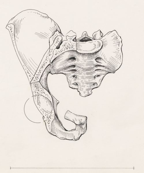 J Tinkelenberg, Cross section of the pelvis