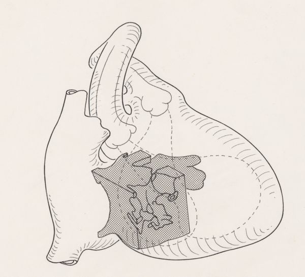 J Tinkelenberg, Schematic representation of the heart and circulatory system