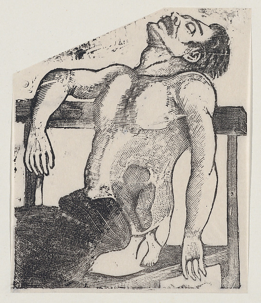 José Guadalupe Posada, A man with a small foot emerging from his side