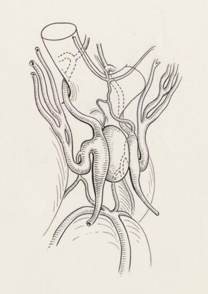 J Tinkelenberg, Circulatory system of the head