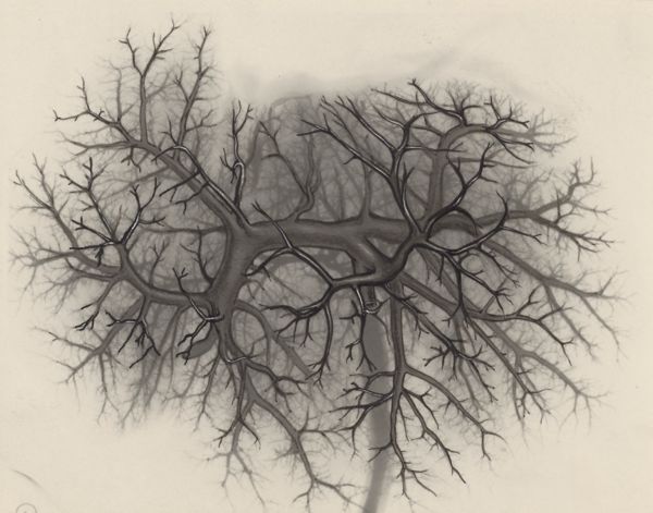 J Tinkelenberg, Bronchi