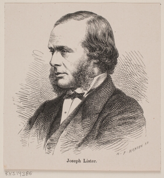 H.P. Hansen, Joseph Lister