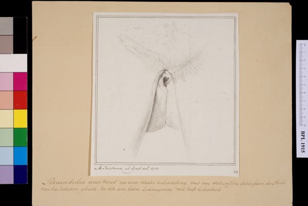 M Houtman, Female genitals