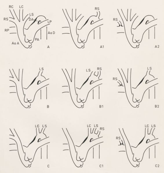 J Wetselaar-Whittaker, Schematic representation of the cardiovascular system