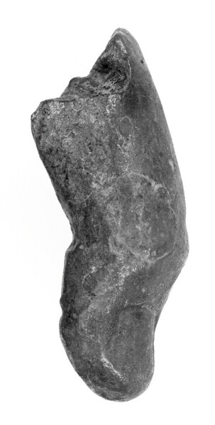 Unknown, Finger or Toe
