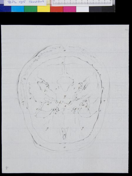 Gerard Sandifort, Skull (calvaria), view from inside (legend)