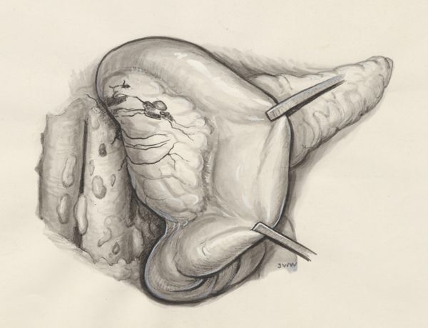 J Wetselaar-Whittaker, Human tissue