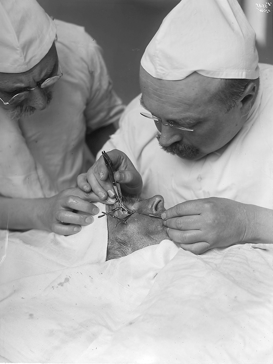 Anders Beer Wilse, Prot: Øienoperation for Dr. Holt
