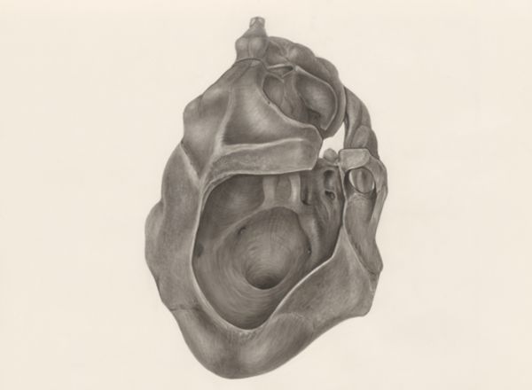 H.G Wetselaar, Deformed skull, seen from below