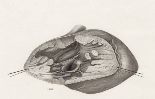 H.G Wetselaar, Heart and adjacent organs
