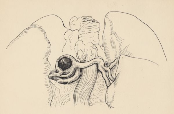 J Tinkelenberg, Part of the heart and circulatory system