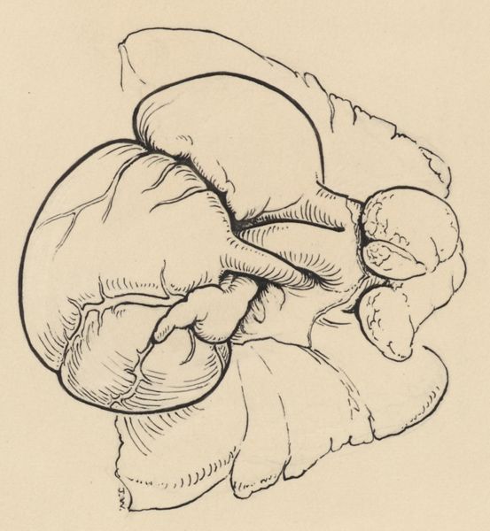 J Tinkelenberg, Schematic representation of the heart and circulatory system