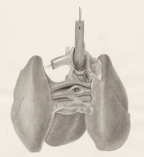 H.G Wetselaar, Lungs and part of the circulatory system