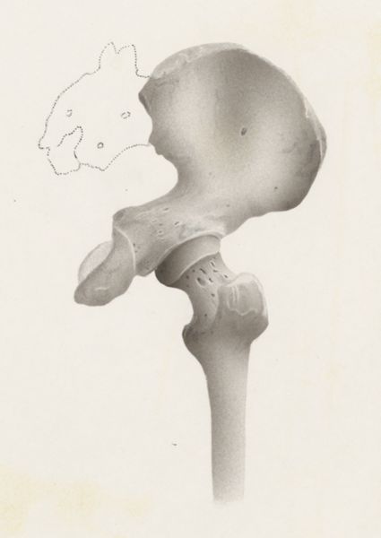 Harry de Bles, Hip joint
