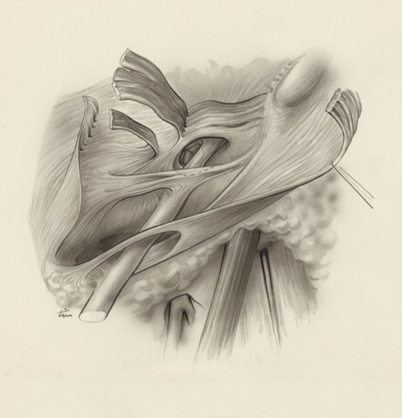 J Tinkelenberg, Cardiovascular system
