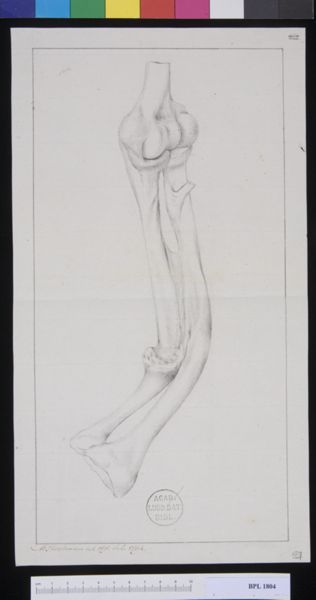 M. Houtman, Pathology, fractures (Forearm)