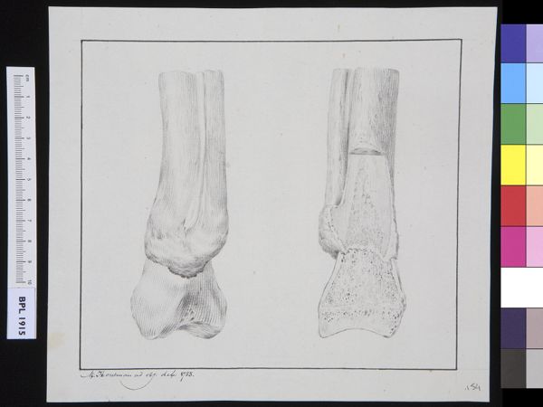 M Houtman, Infected bone