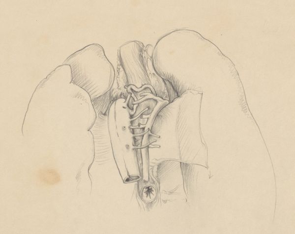 J Tinkelenberg, Part of the heart and circulatory system