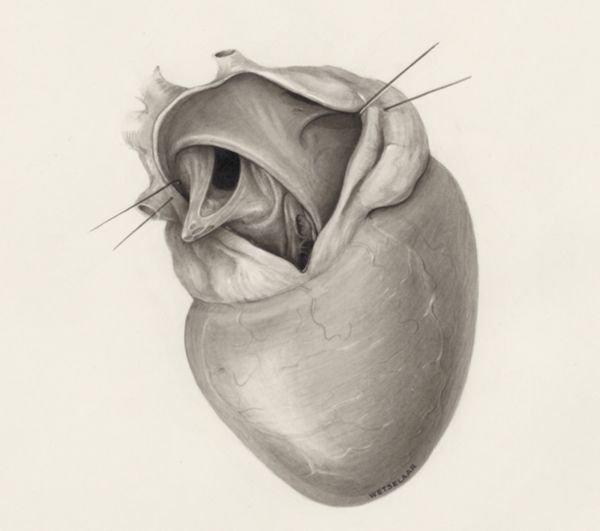 H.G Wetselaar, Heart