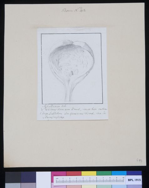 A Bonn, Bladder of a child