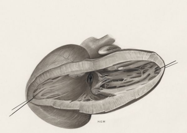 H.G Wetselaar, Heart and adjacent organs