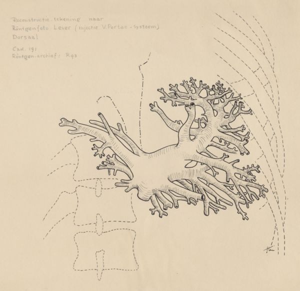 J Tinkelenberg, Reconstruction drawing after a liver x-ray