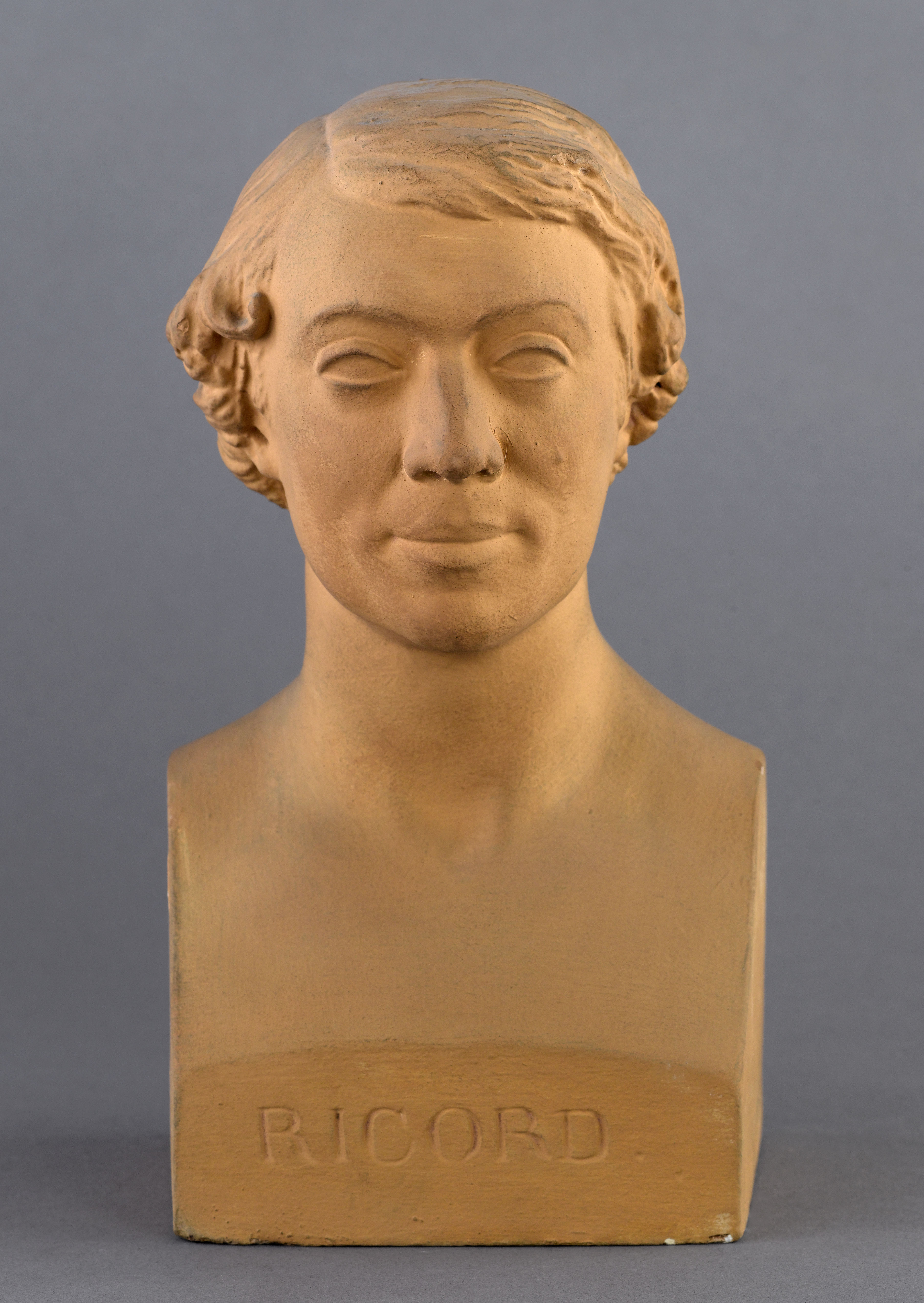 Jean Pierre Dantan, Portrait sérieux du chirurgien et syphilologue, Philippe Ricord (1800-1889)