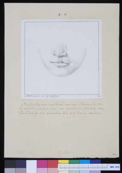 M Houtman, Child with cleft palate
