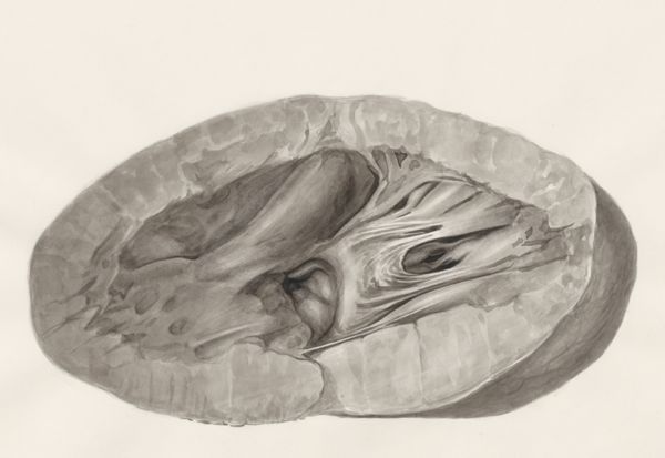 H.G Wetselaar, Heart