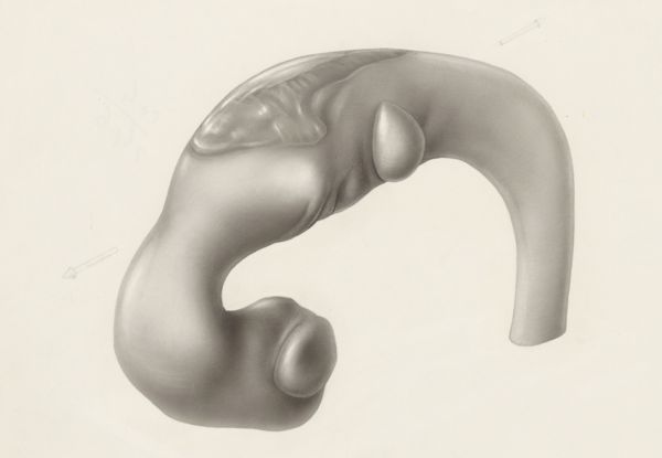J Tinkelenberg, Hearing organ of an embryo