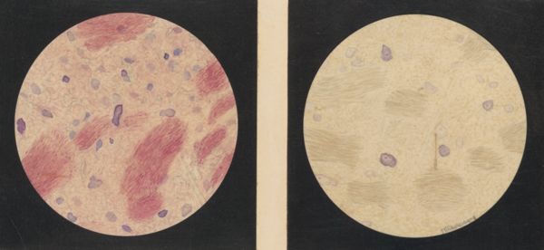 J Tinkelenberg, Microscopic views of the central nervous system