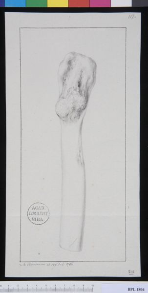 M. Houtman, Pathology, fractures (Femur)