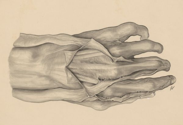 J Tinkelenberg, Muscular tissue of the hand and fingers