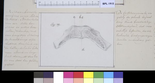 M Houtman, Pubis bone