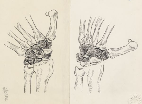 J Tinkelenberg, Musculoskeletal system of the hand and wrist