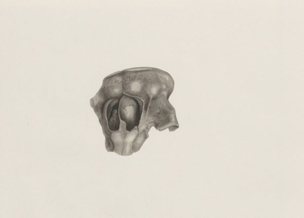 H.G Wetselaar, Part of a deformed fetal head