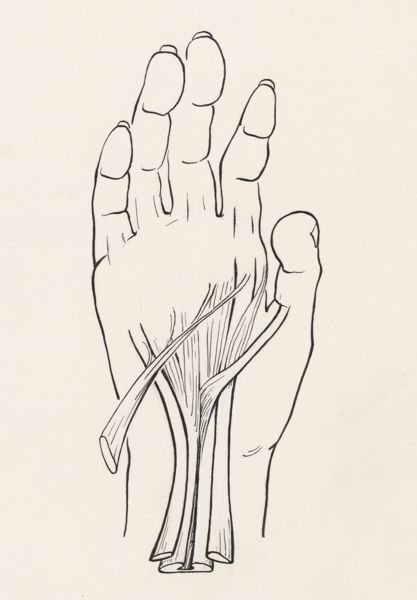 J Wetselaar-Whittaker, Musculoskeletal system of the upper extremity